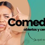 _FARMATEN - Artículo comedones abiertos y cerrados)